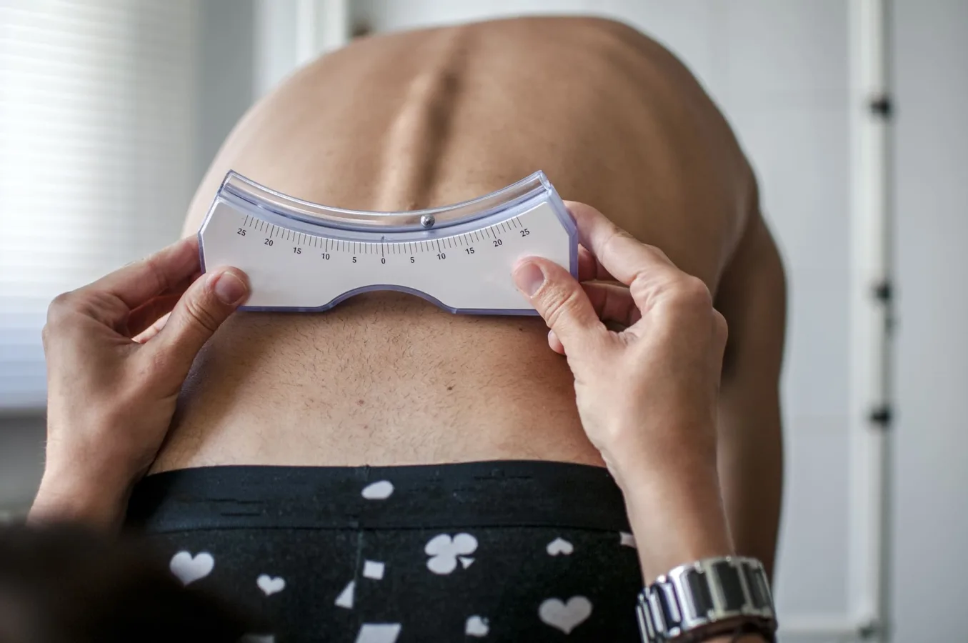 ¿Qué especialista trata el dolor lumbar en CDMX? | Cirujano de Columna